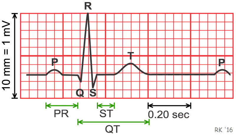ECG trace with measurement grid